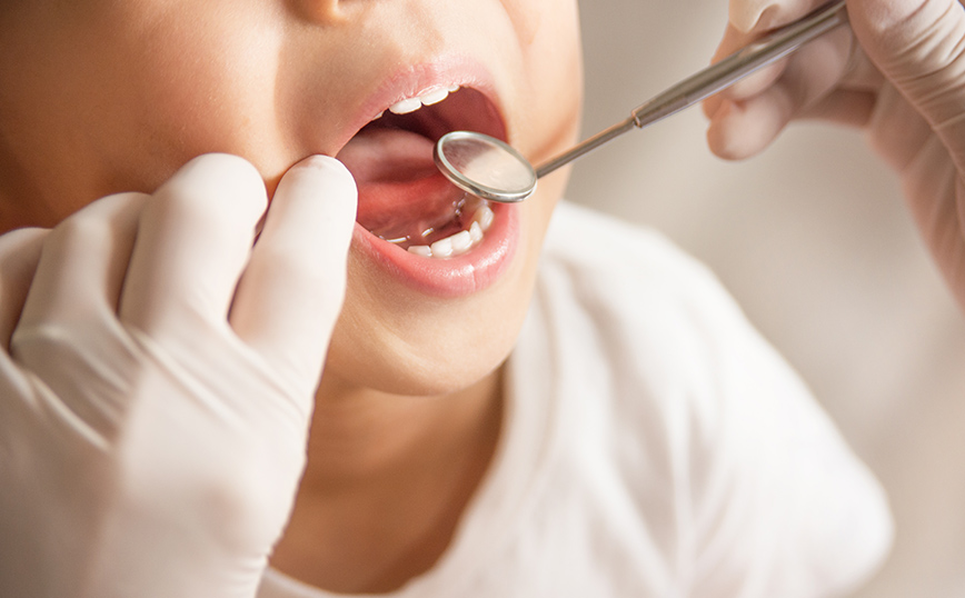 Dentist Pass: Δωρεάν οδοντιατρικός έλεγχος για παιδιά - Πώς θα λάβετε τα voucher